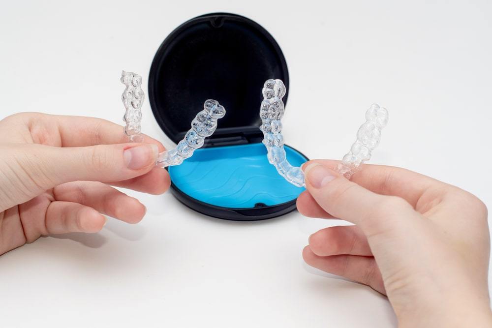 Invisalign: what are the advantages of this technique?