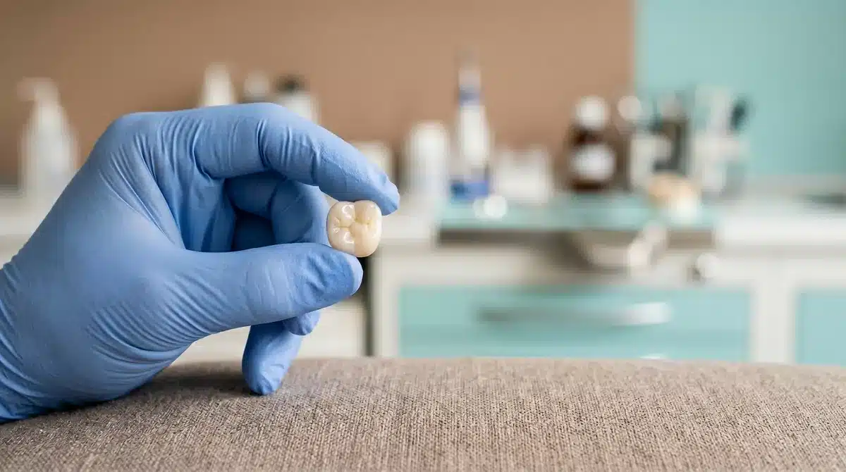 Dental Crowns 2026 Cost: $900 to $1,500 in Quebec